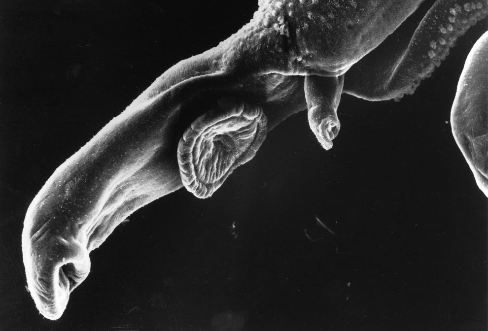шистосом кровяной сосальщик под микроскопом, фото