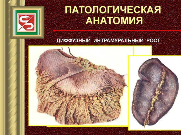 патологическая анатомия