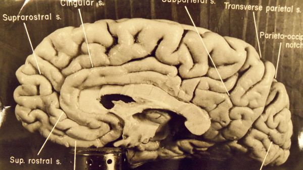 16. Мозг Эйнштейна был извлечен почти сразу после смерти ученого. 