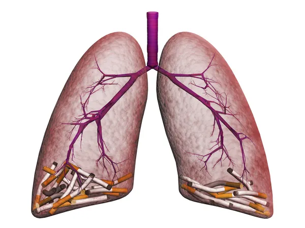 Легкие курильщиков на белом фоне — стоковое фото