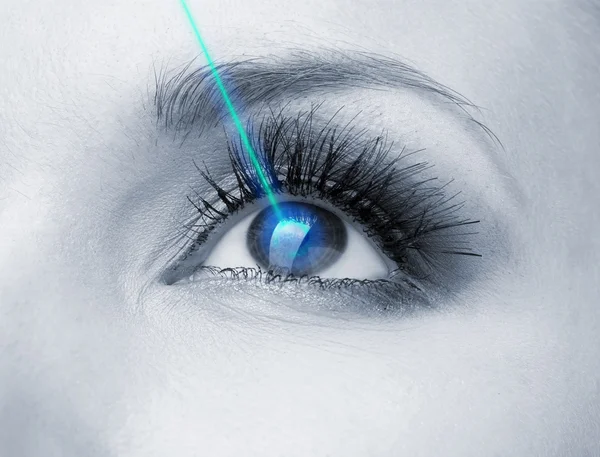Лазерное исправление видения. глаз женщины — стоковое фото