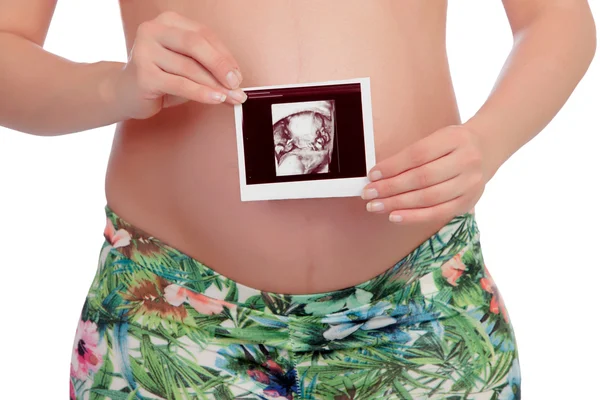 Взволнованная беременная женщина с ultrasond ее маленькой женщины — стоковое фото