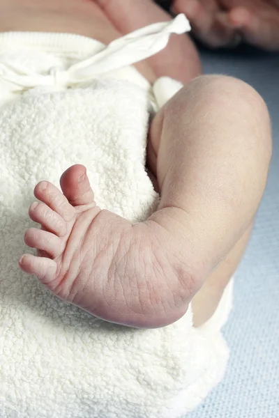 Крупным планом косолапости новорожденного Лицензионные Стоковые Изображения