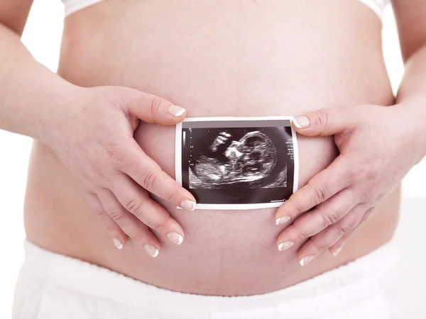 Беременная женщина, держащая УЗИ — стоковое фото