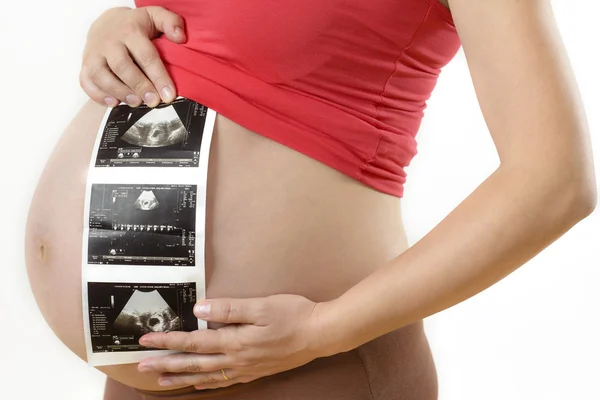 Беременная женщина, держащая фото УЗИ — стоковое фото