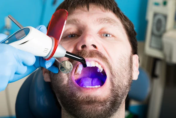 Врач осматривает полости на кариес. Защита кариеса. Лечение кариеса зубов. Стоматолог, работа с лампа стоматологическая полимеризации в ротовой полости — стоковое фото