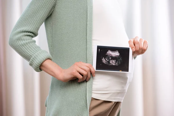 Беременная женщина с ультразвуковым сканированием ребенка — стоковое фото