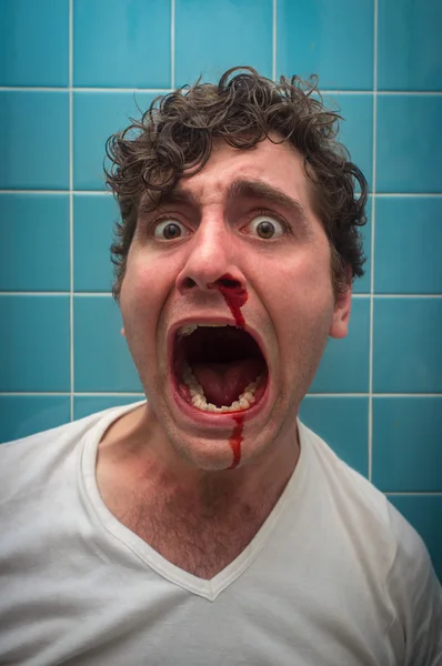 Кровавый нос человек — стоковое фото