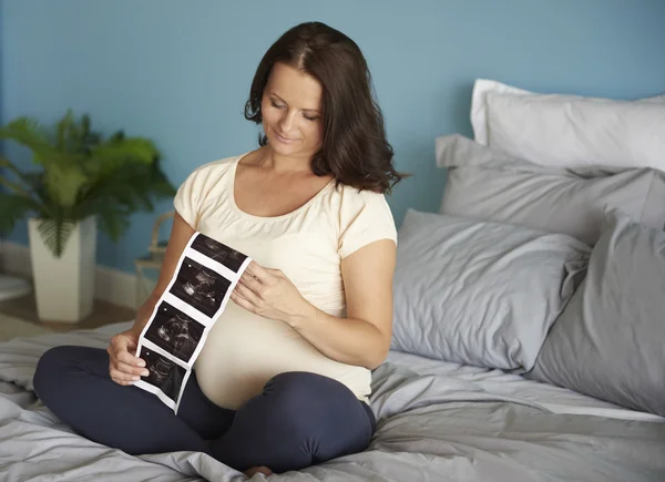 Беременная женщина просмотра ультразвуковое изображение — стоковое фото